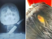 Mulher fica com faca cravada no pescoço após ex tentar matá-la e agredir a filha dela em Mineiros (GO)