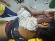 Mulher fica com faca cravada no ombro ao ser agredida pelo ex em MS